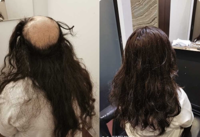 Hair Replacement SG Profile Image